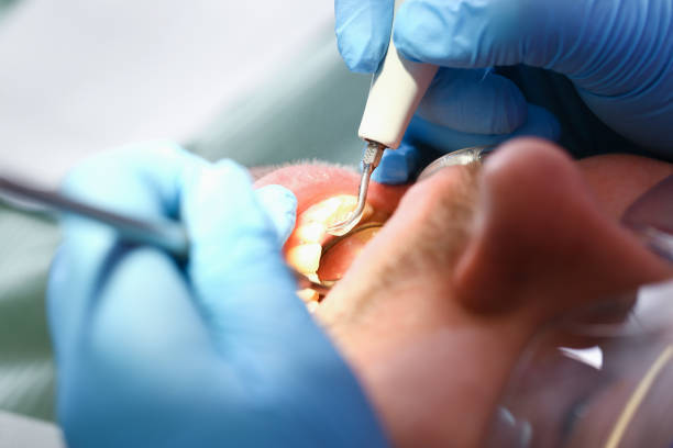 Best Emergency Tooth Extraction  in Verdigris, OK