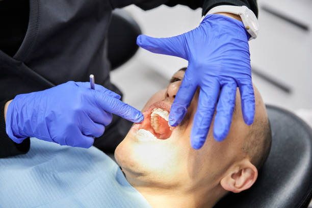 Best Knocked-Out Tooth Emergency  in Verdigris, OK